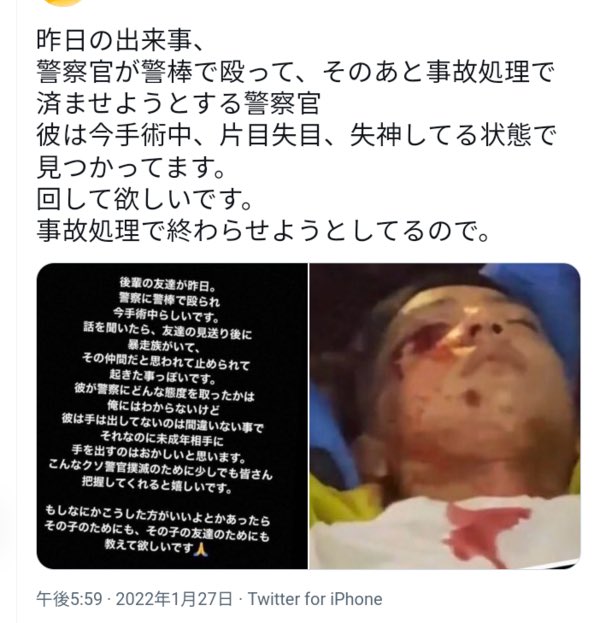 FKLikQNVcAAEcCg - 【特定】眼球破裂した高校生は不良で警察に殴られたのはデマでインスタ垢で非行自慢している件【沖縄警察署襲撃暴動事件】